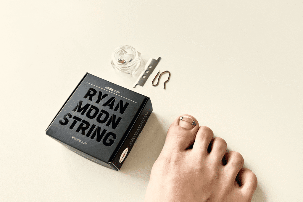 내성발톱 자가치료를 위해 라이언문 내성발톱 교정기를 착용한 발과 도구 및 포장이 베이지 배경 위에 놓여 있음.